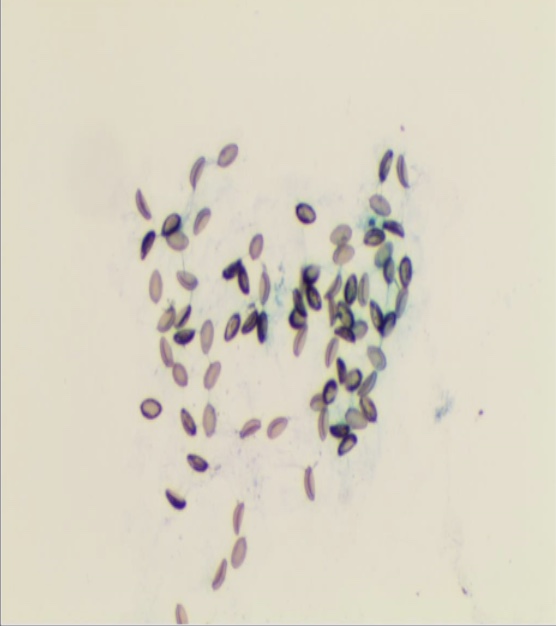 头皮发麻爱吃鱼生的他胆汁里全是西瓜子