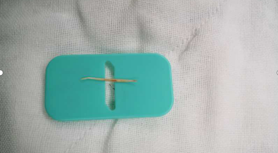 小鱼刺不知不觉吞落肚,几天后竟致胃肠穿孔!