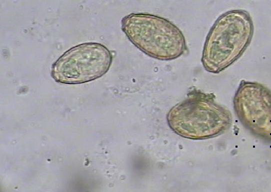 肝吸虫卵形态描述图片