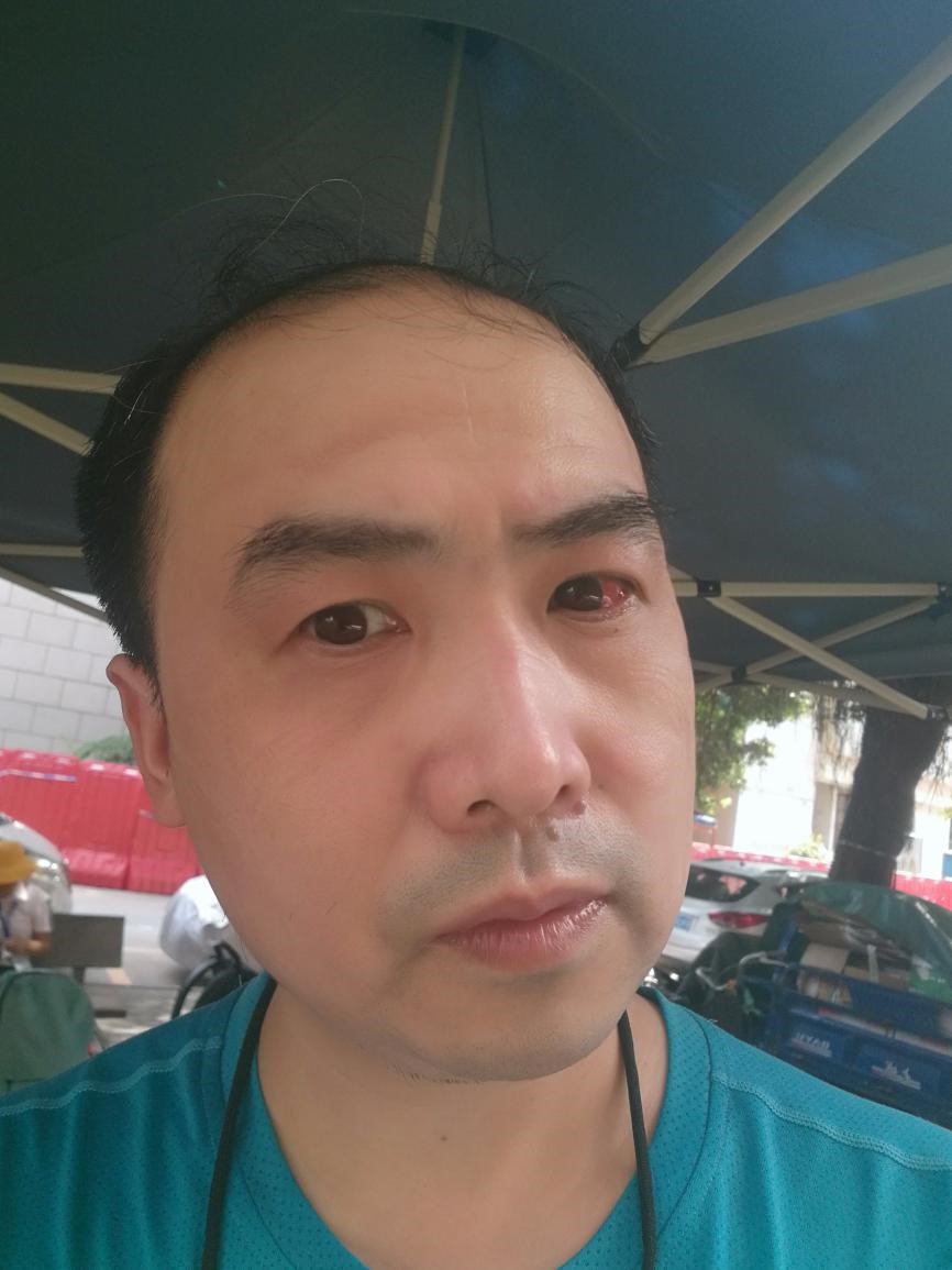 (图:图书馆党支部书记邹琦同志右眼被清洁剂渗入仍坚持工作)