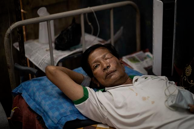 整个人发霉而死可怕疾病蔓延印度